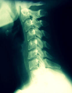 chiropractic care for work injuries